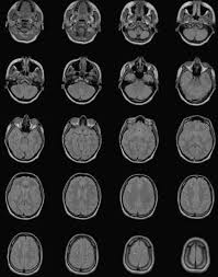 Custom Software and DLLs for Medical Image Conversion